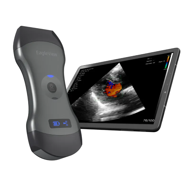 EagleView™ Dual-head Wireless Handheld Ultrasound