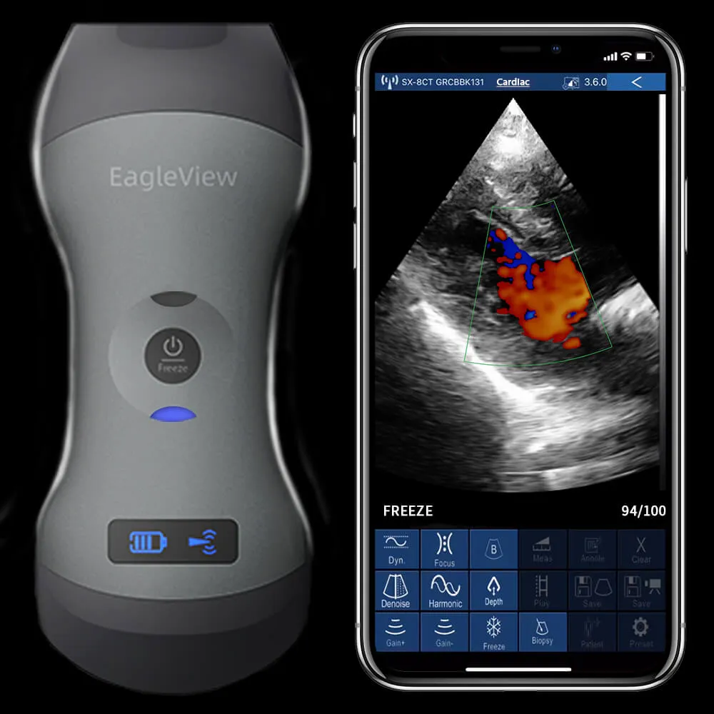 EagleView™ Dual-head Wireless Handheld Ultrasound