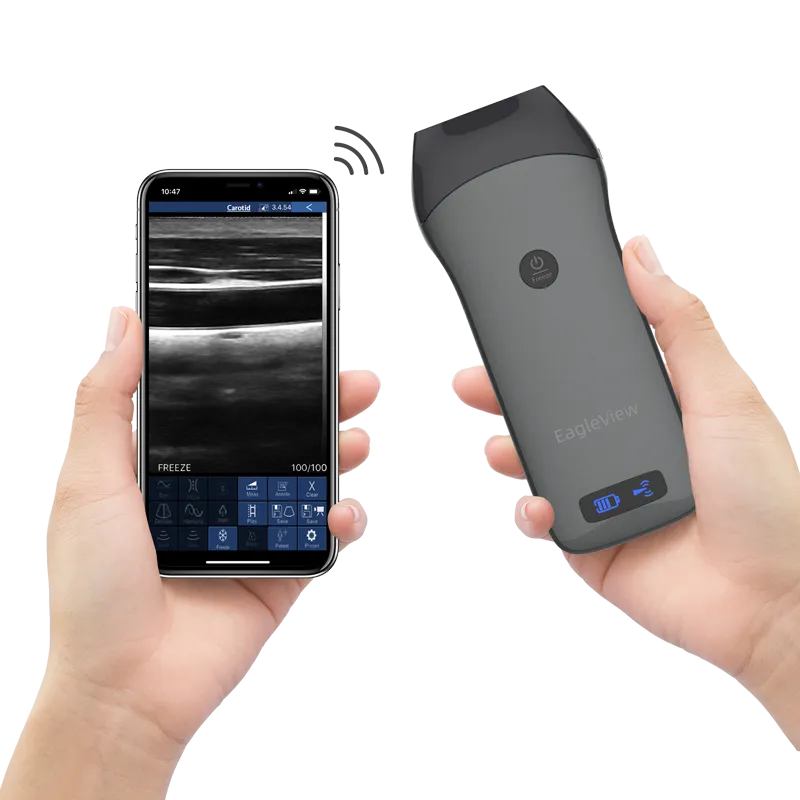 EagleView™ Linear Wireless Handheld Ultrasound