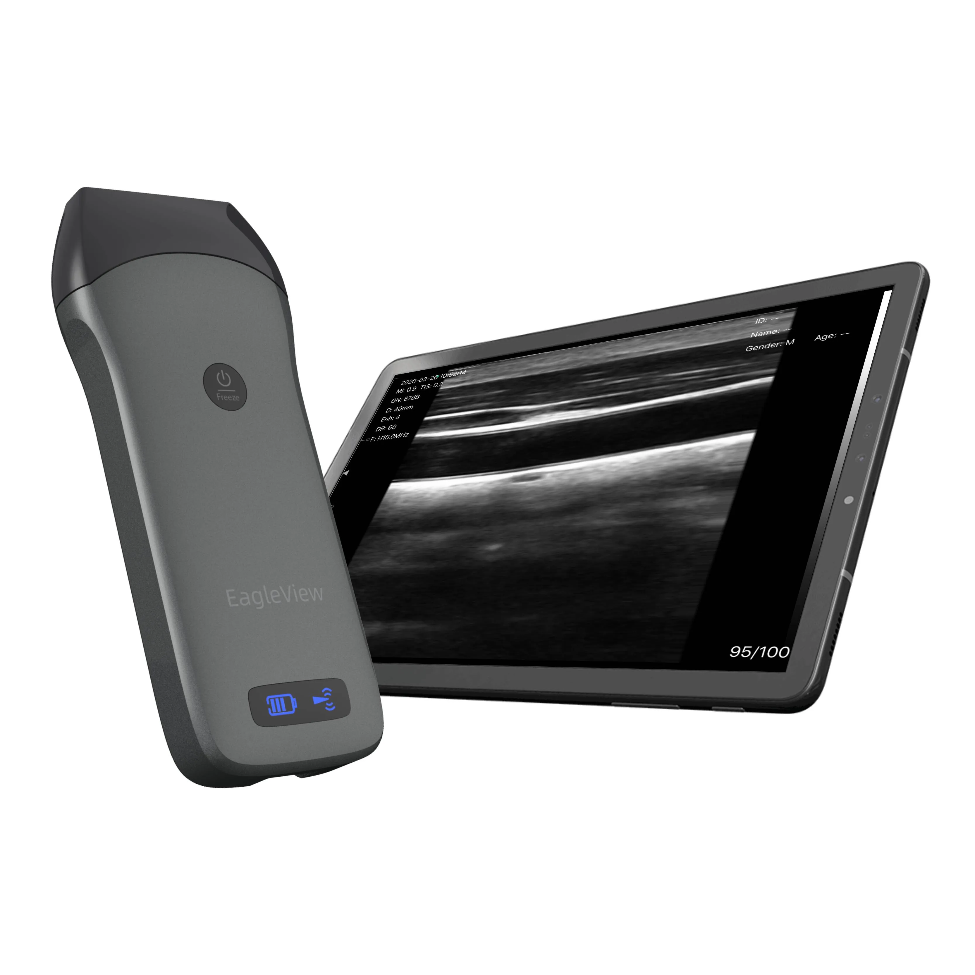 EagleView™ Linear Wireless Handheld Ultrasound